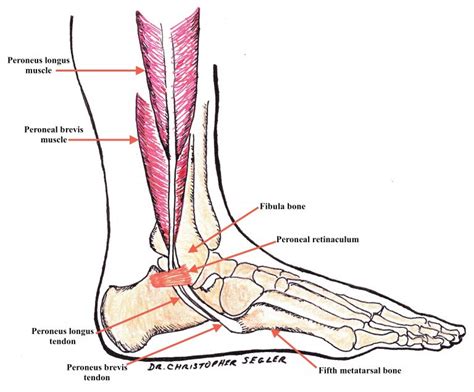 Peroneal Tendon Injuries In Runners An Overview From The Runners