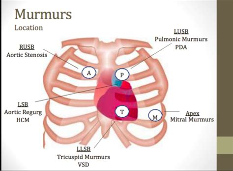heart murmurs and sounds flashcards quizlet