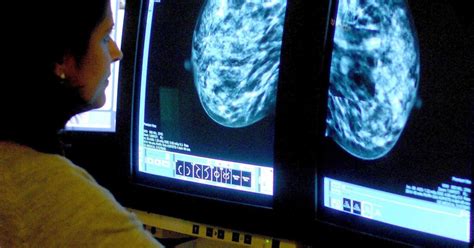 False Positive Mammogram Result May Point To Higher Risk