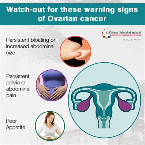 Ovarian Cancer Warning Signs