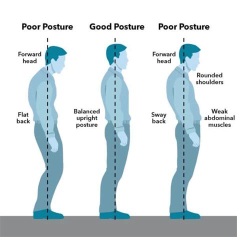The Impact Of Posture And Positioning With Hypermobility