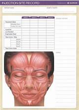 Images of Botox Treatment Record Form