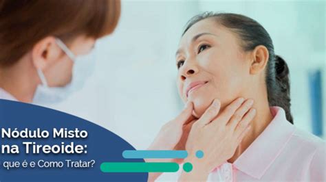 Nódulo Misto Na Tireoide é Grave