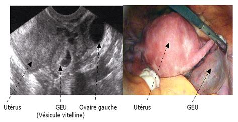 Algies Pelviennes Aigues De La Femme Aux Urgences Urgences Online