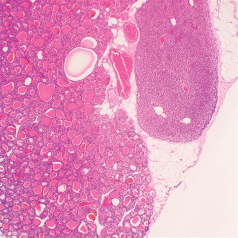 Mammal Thyroid Gland And Parathyroid Gland Sec 7 M Hande Microscope