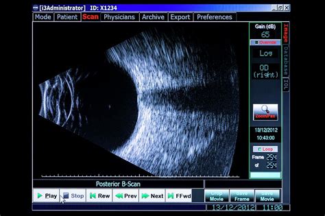 Ultrasound Eye Examination Photograph By Jim Varneyscience Photo