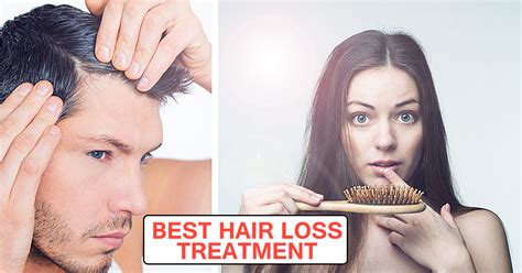 Best Hair Loss Treatment A Lot Of Options An Easy How To Guide