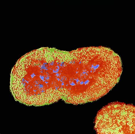 World Health Organization Untreatable Gonorrhea On The Rise
