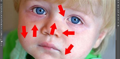 Check spelling or type a new query. Remove Blemishes From a Face Using Photoshop Quickly and ...