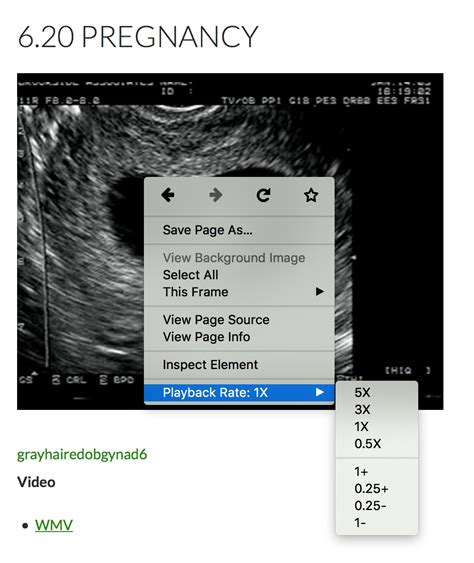 Video Speed Control Obgyn Morning Rounds