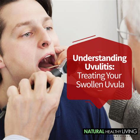 Understanding Uvulitis Digital Art By Healthy Livingz Fine Art America