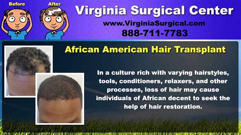 I used it consistently for nearly a year when really needed and then sporadically for maintenance. Hair Regain | Hair Loss Women Treatment | Virginia ...