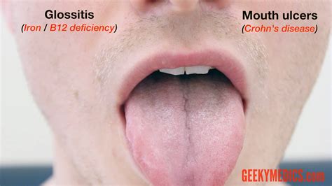 Abdominal Examination Osce Guide Geeky Medics