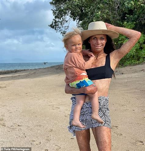 Turia Pitt Reveals How She Honestly Explains Her Injuries To Her Babe Son Daily Mail Online