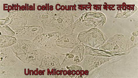 Epithelial Cell Under Microscope Epithelial Cells In Urine Youtube