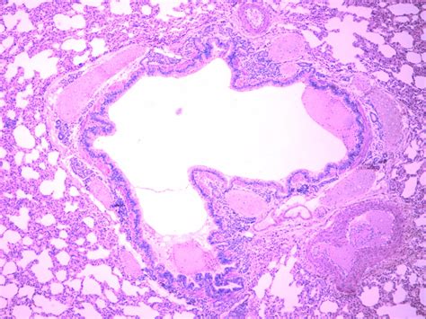 Bronchus Slide Labelled