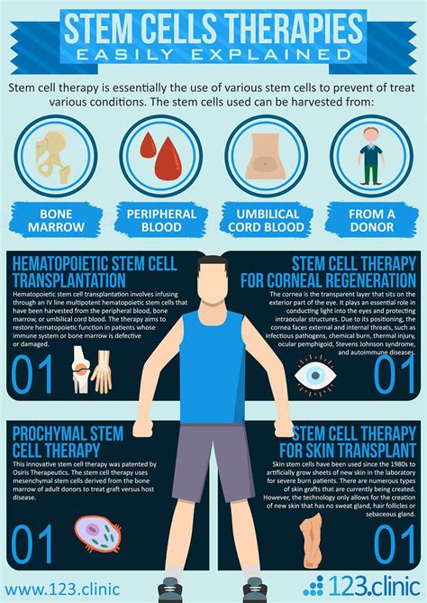 Stem Cells Therapies Easily Explained Infographic Infographics