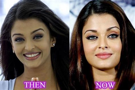 10 Bollywood Actresses Who Went Through Plastic Surgery