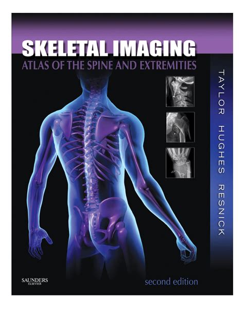 Pdf Skeletal Imaging Atlas Of The Spine And Extremities