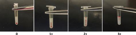 Scoring Of Agglutination In A Crossmatch With The Stallside Kit KIT Download Scientific