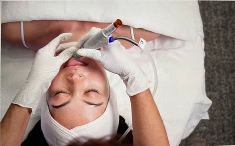 Back Facials By Torstveit Medical Aesthetics In Phoenix Az Alignable