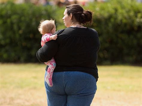Gestational Weight Gain In Obese Women Better With Program
