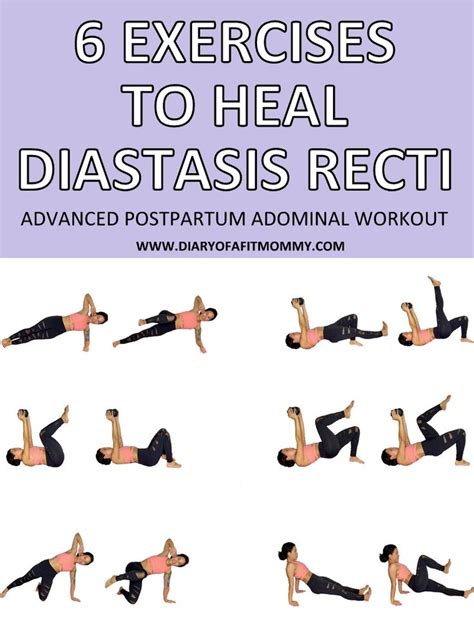 6 Exercises To Fix And Heal Diastasis Recti Advanced Postpartum