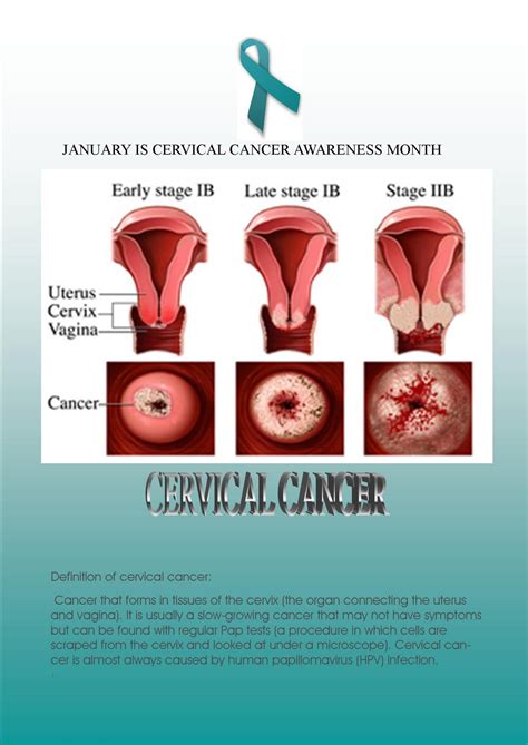 Cervical cancer occurs when abnormal cells on the cervix grow out of control. Everyday Wellness With Dr. KC Goff: Cervical Cancer ...