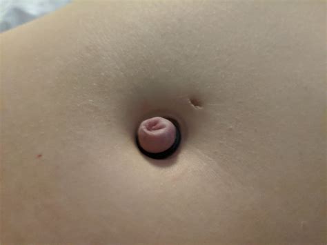 My Outie Belly Button Torture Photos Xxx Porn Album