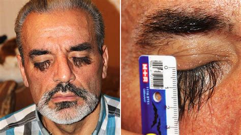 Secret Food Gives Man Incredibly Long Eyelashes Which Leave Women
