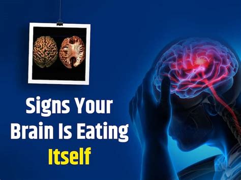 7 Warning Symptoms Your Brain Is Eating Itself