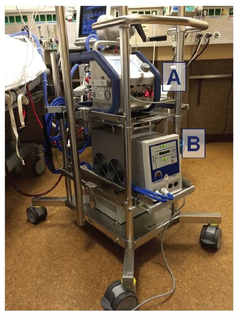 Trial baby on ecmo and is. Survival Rate of COVID-19 Patients on ECMO Machines are ...