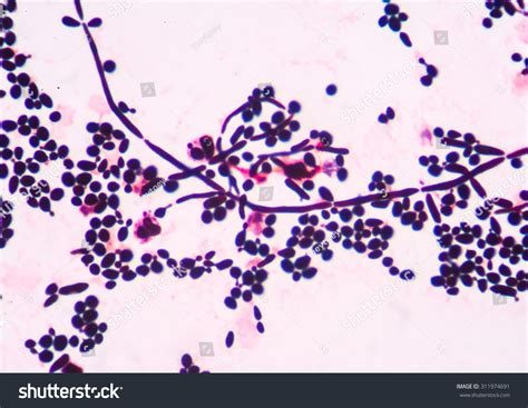 871 Budding Yeast Cells Images Stock Photos And Vectors Shutterstock