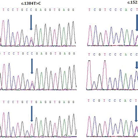 Sanger Sequencing Of Sepn1 Identified Two Heterozygous Novel Mutations Download Scientific