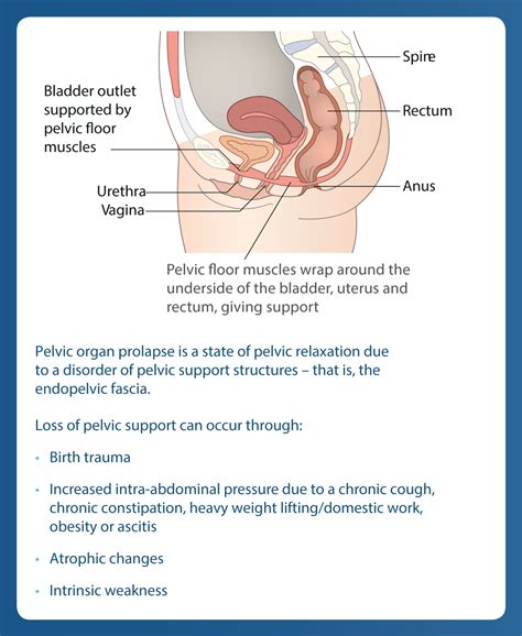 Female Genital Prolapse Gynaecological Perspective