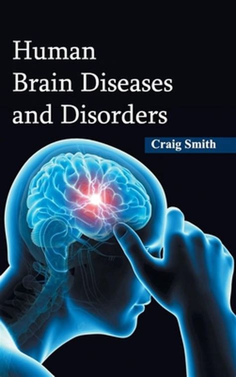 Human Brain Diseases And Disorders Boeken Bol