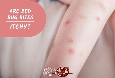 Bed Bugs Bites Look Like Stelianadesign