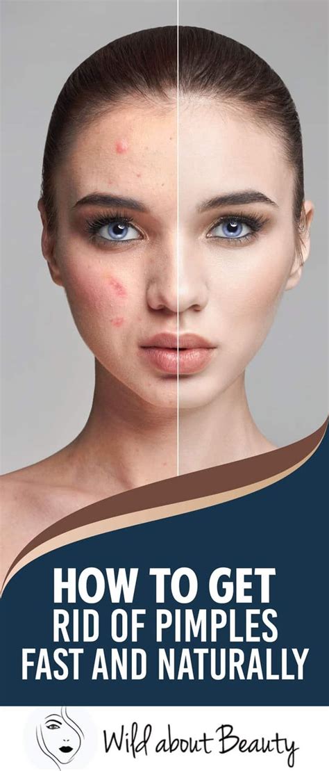 How To Get Rid Of Pimples Fast And Naturally How To Get Rid Of