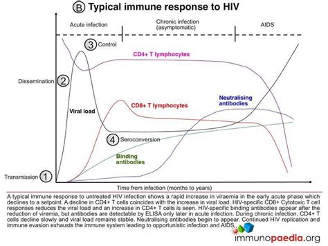 Hiv Acute Retroviral Syndrome Case Study Immunopaedia