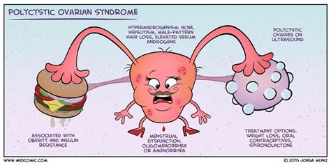 Polycystic Ovary Syndrome 7450 Case Study