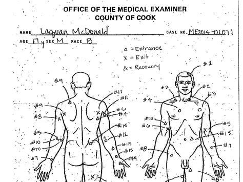 Autopsy Incision Diagram