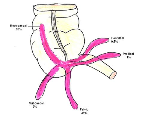 Appendix Location Diagram