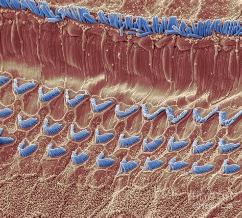 Inner Ear Hair Cells Sem By Steve Gschmeissner Ear Hair Ear Inner Ear