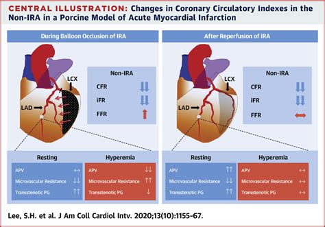 Coronary Circulatory Indexes In Non Infarct Related Vascular