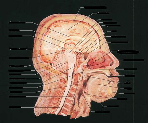 Sagittal Section Of The Head Diagram Quizlet