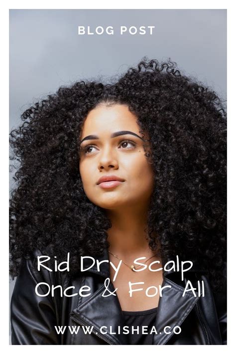 Set your dryer to a low setting and dry your hair gradually over a longer period of time. Get Rid of Your Dry Scalp Once and for All | Diy ...