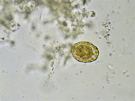 Egg Of Parasitic Nematode Worm Roundworm Ascaris Lumbricoides Banco De