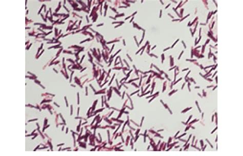 Bacillus Cereus Simple Stain