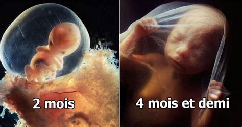 Quelle Est La Taille Dun Embryon De Semaines Planetefemmes Magazine D Informations Pour