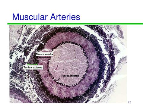 PPT - Exercise 21 PowerPoint Presentation, free download - ID:3112619